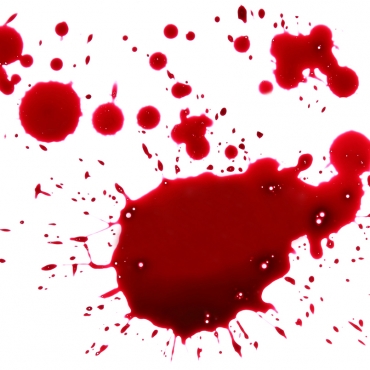 Stopping menstrual bleeding via contraceptive pills due to endometriosis